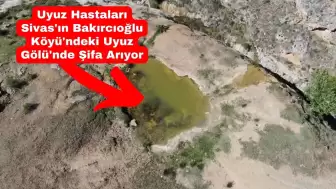 Uyuz Hastaları Arttı, Şifa Arayanlar Sivas'taki Uyuz Gölü'ne Akın Ediyor